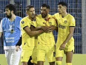 Lateral do Peñarol é atingido por pedrada em jogo da Libertadores; confira